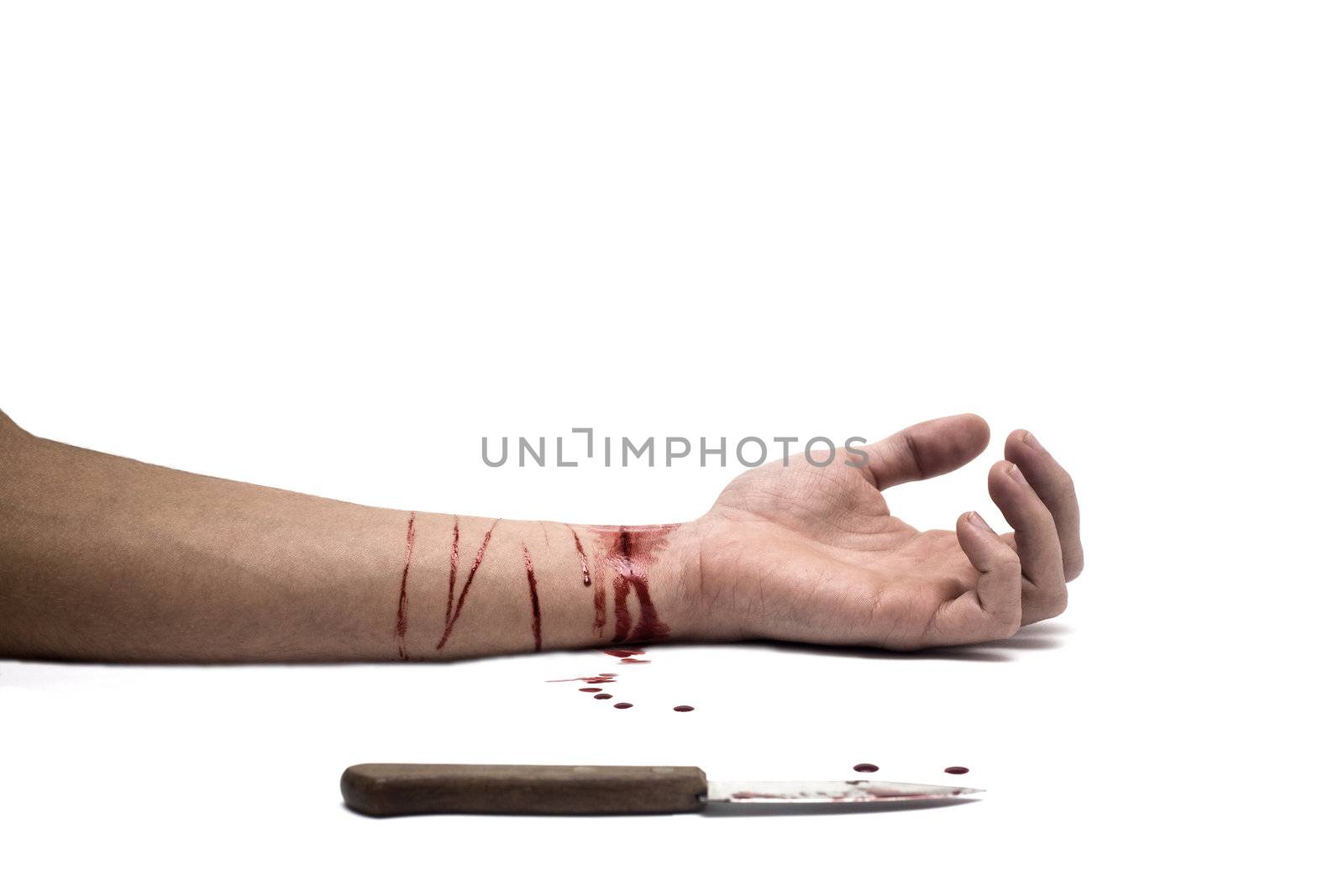 A bloody knife and a cut wrist, isolated on white. This image has innumerous uses like accidents, domestic violence, suicide, murder, hate, etc...
