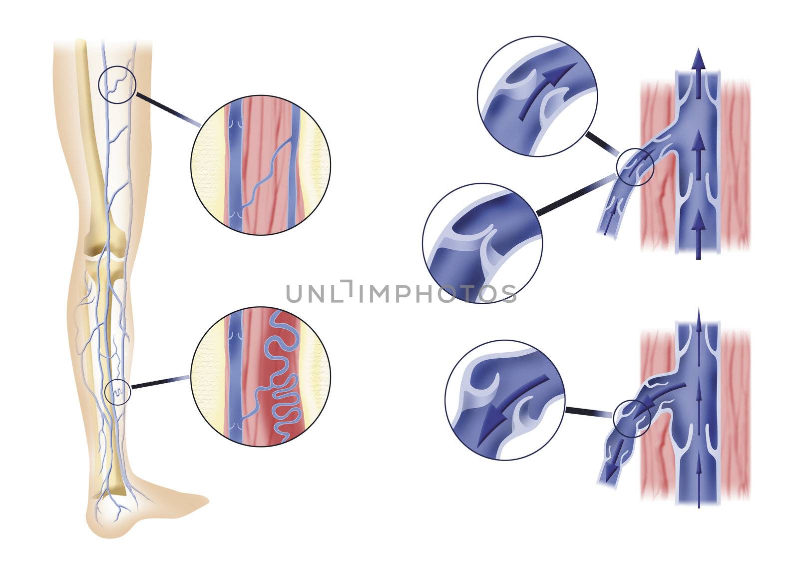diagram section illustration of leg artery and aortic valves