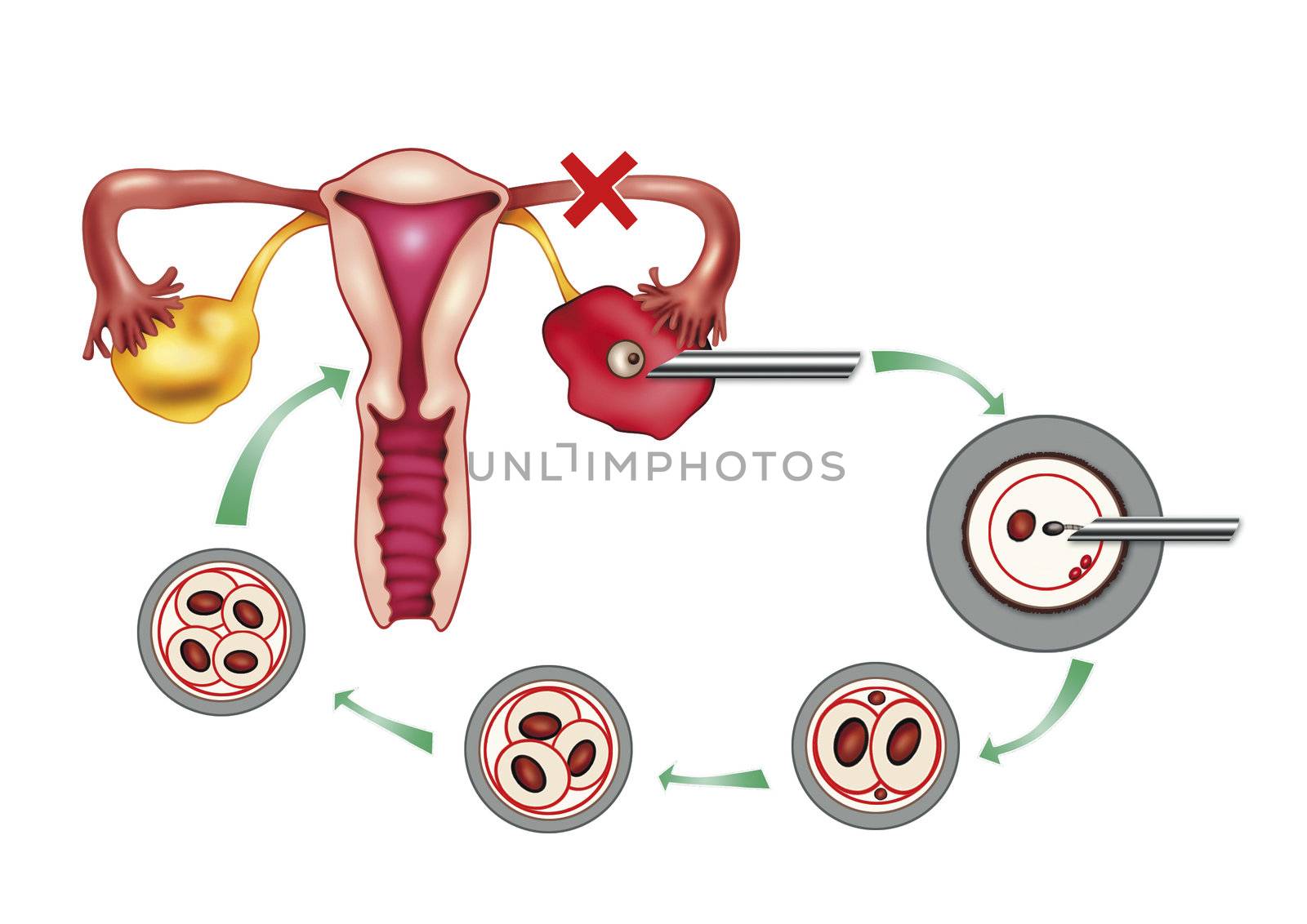 diagram illustration of artificial insemination process