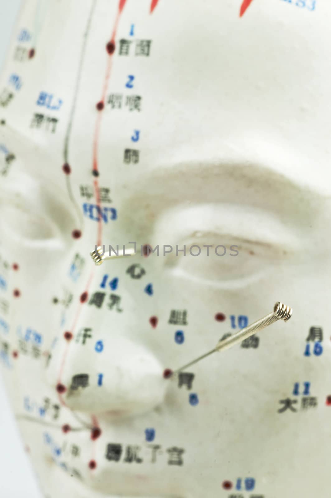 Acupuncture needles on head model by Jochen