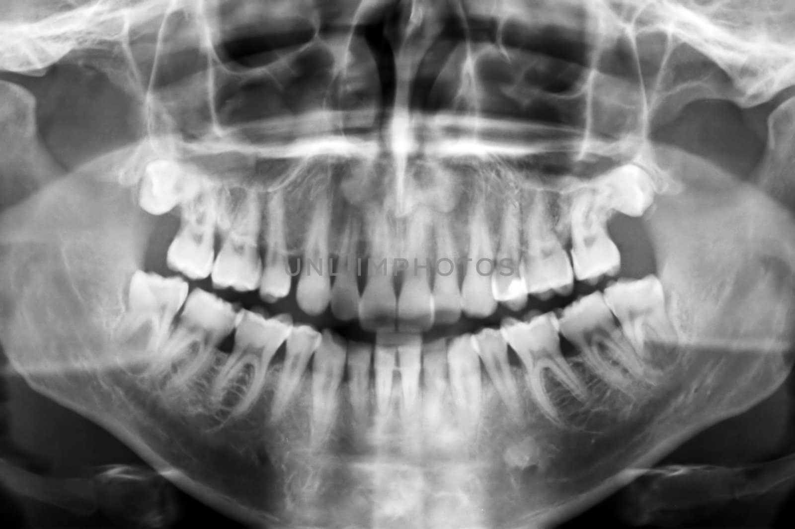 dental scan by sirylok