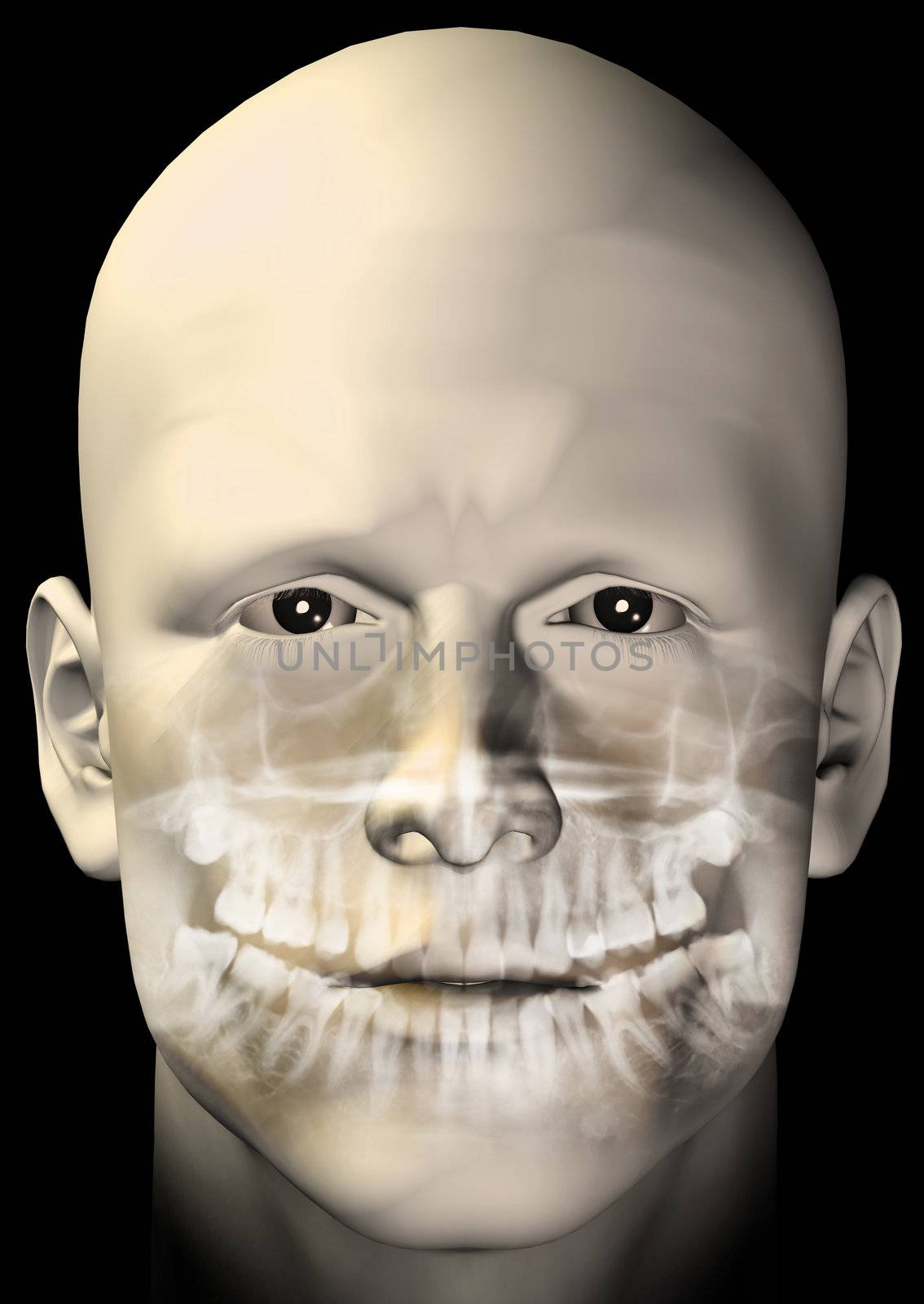Male figure portrait with dental scan x-ray. 3d computer generated illustration.
