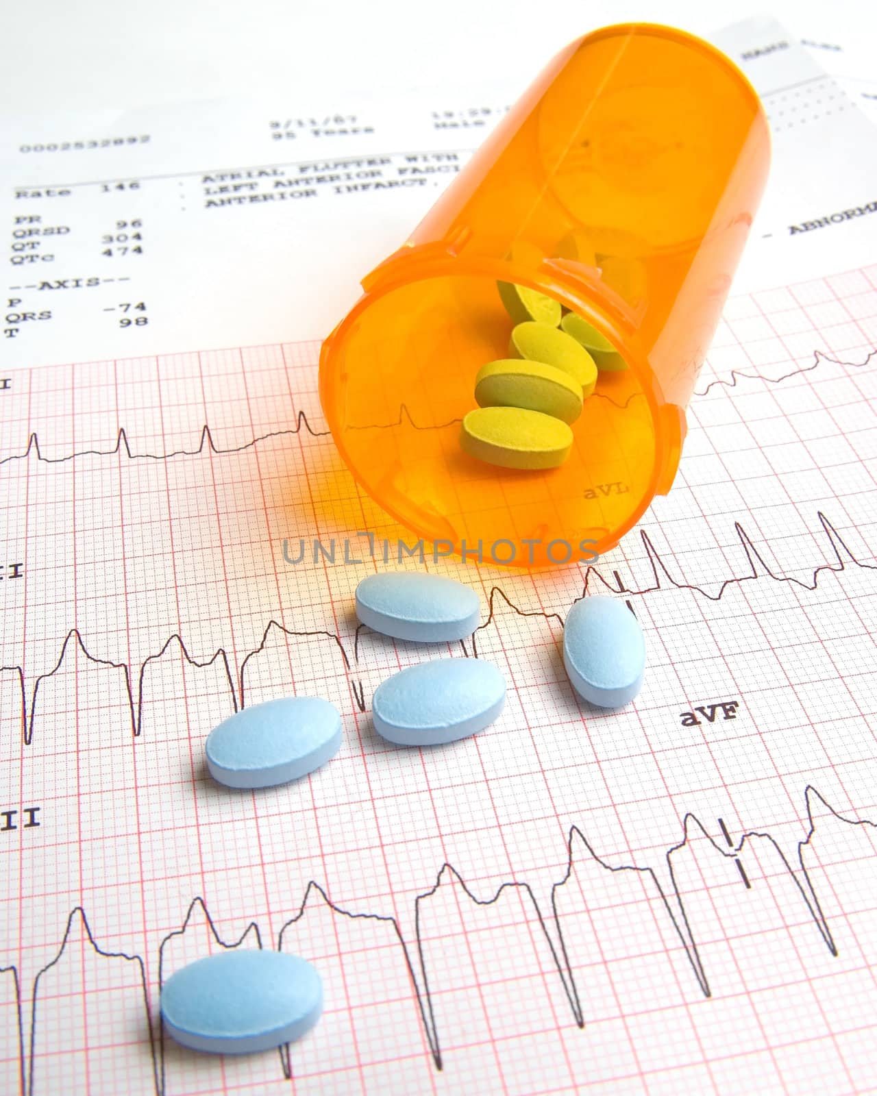 a bottle of pills on a EKG strip