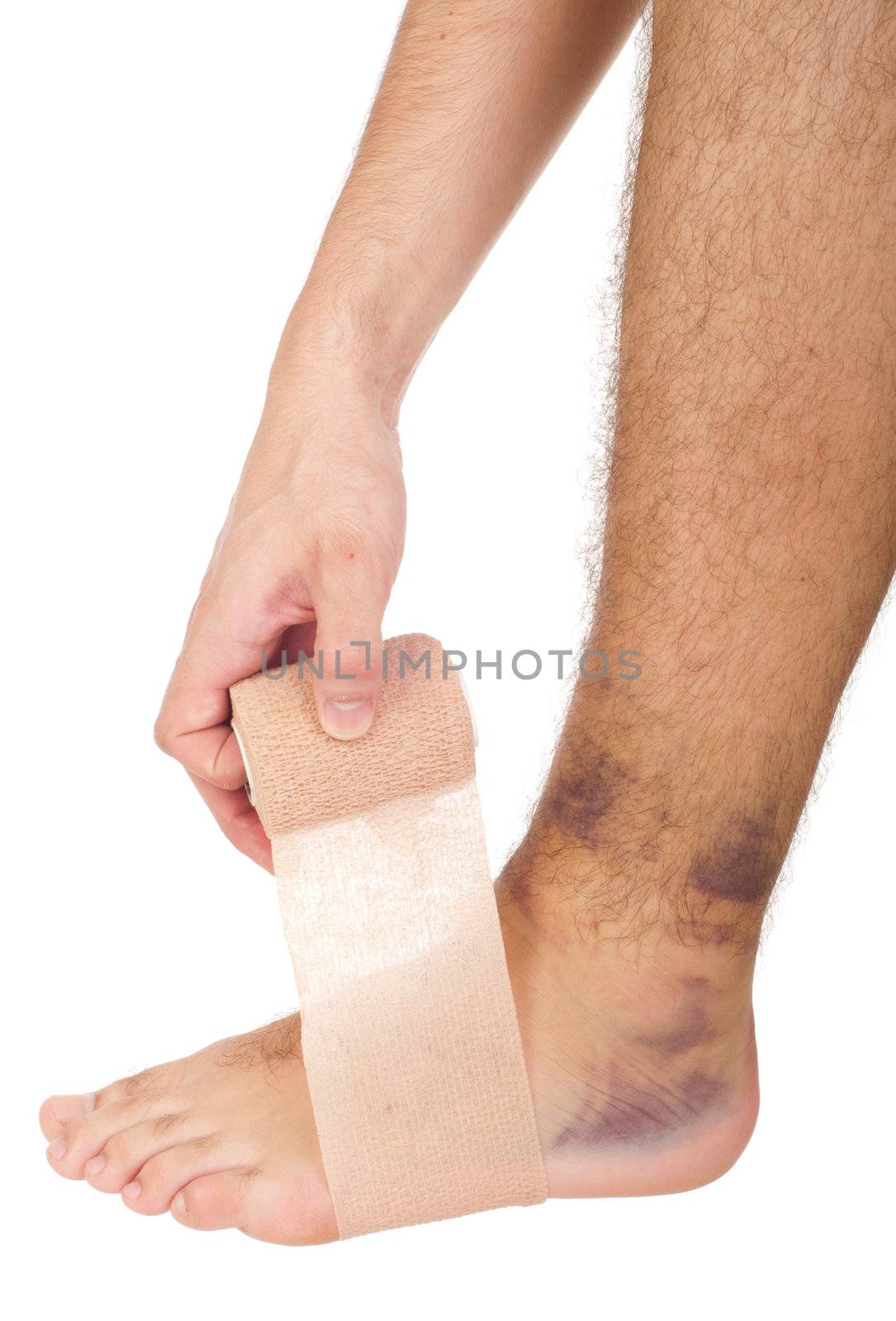 young male with sprained ankle applying medical bandage (isolated on white background)