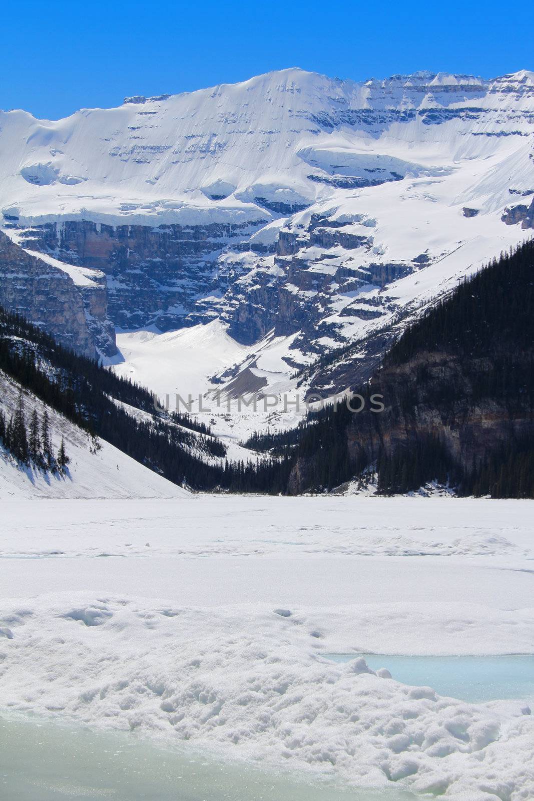 Lake Louise in Banff National Park, Alberta Canada