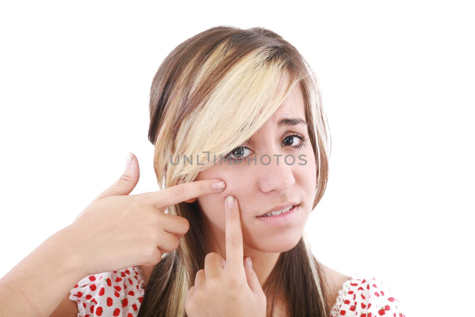 Acne facial care teenager woman squeezing pimple on white