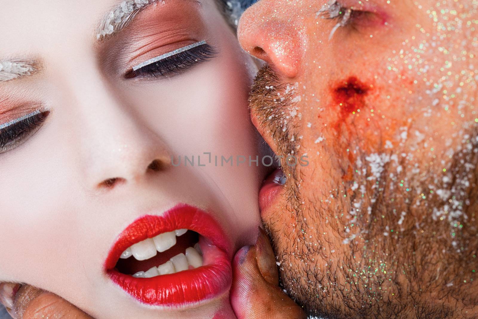 Close-up of wounded male face kissing woman on cheek, both faces covered with frost