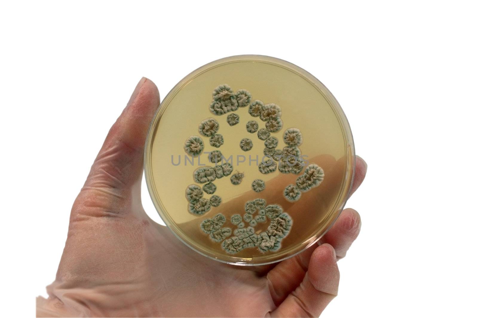 arm with the laboratory plate with microorganisms isolated