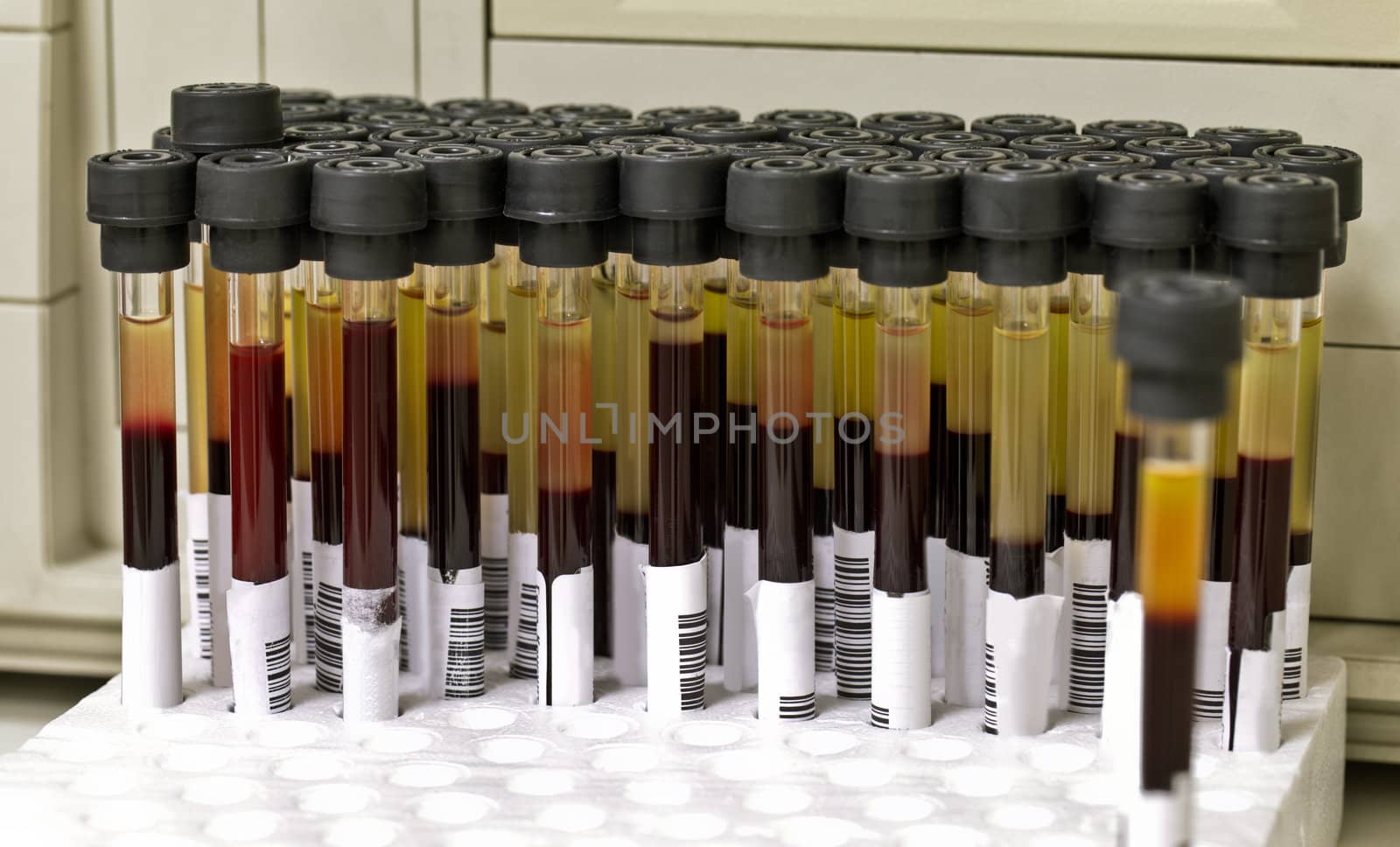 Blood samples tubes by vilevi