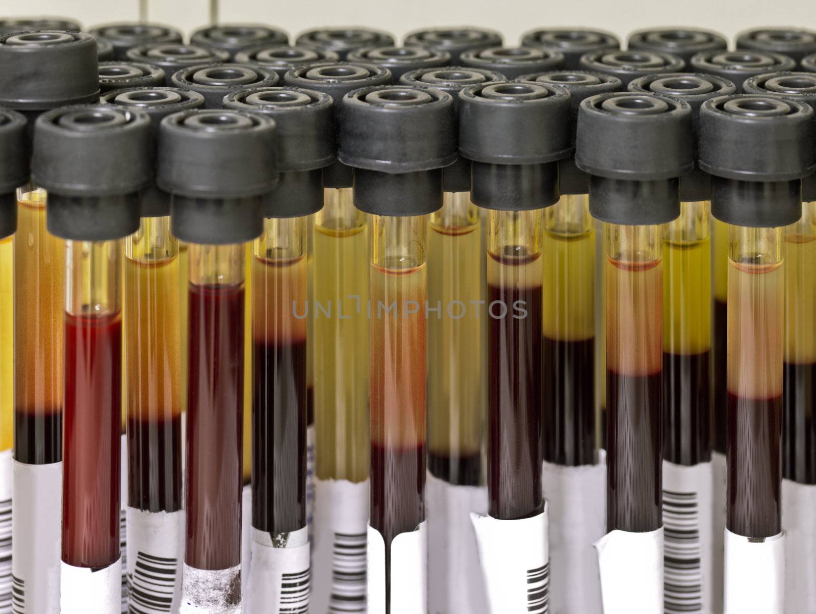 Close-up of test tubes with blood for analysis