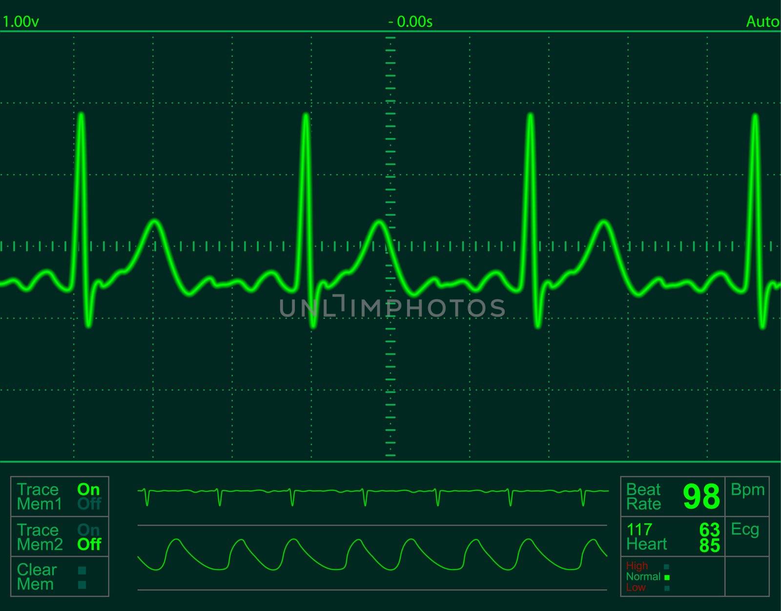 heart monitor screen by dip