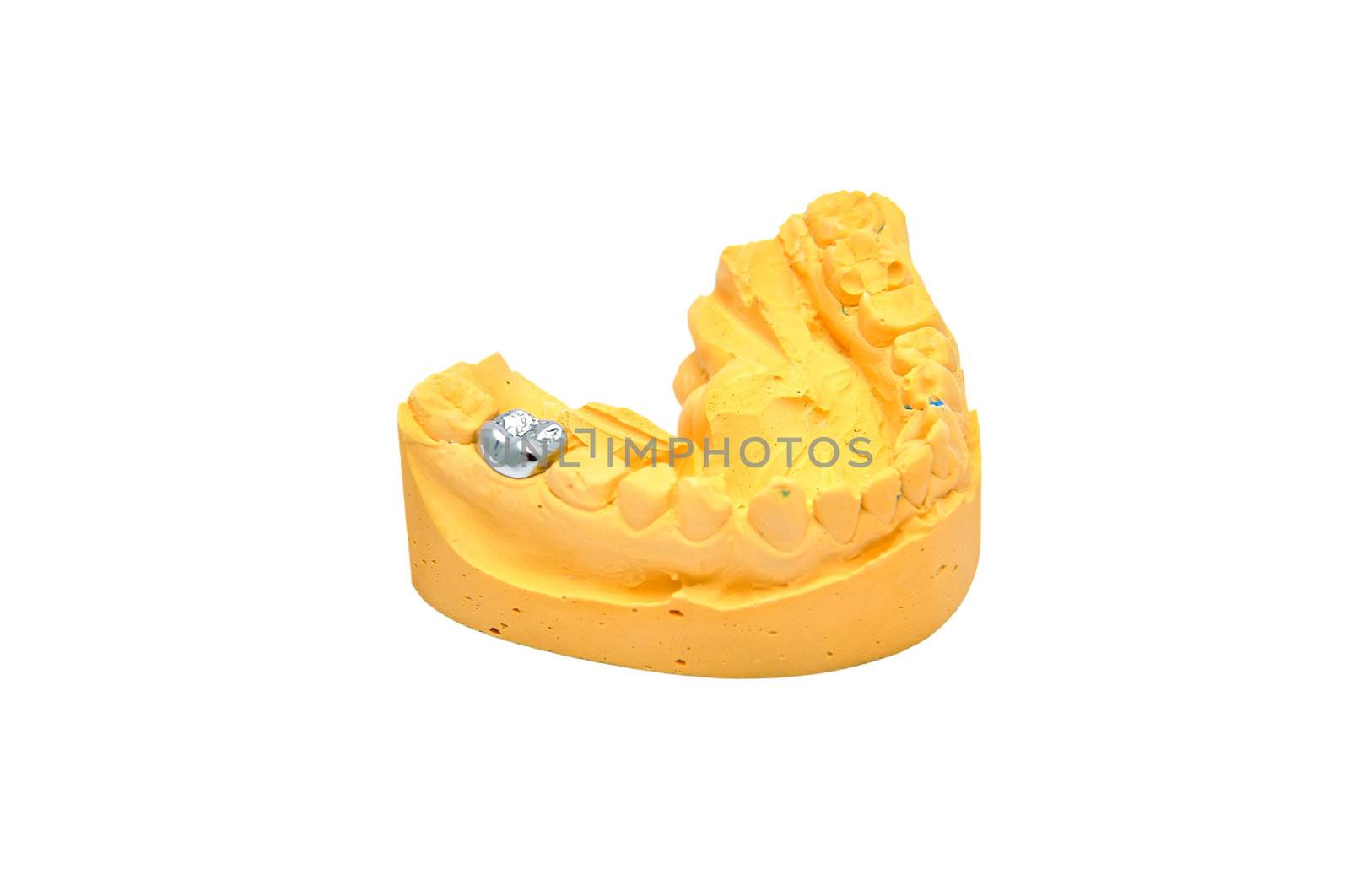 dental mould by vetkit