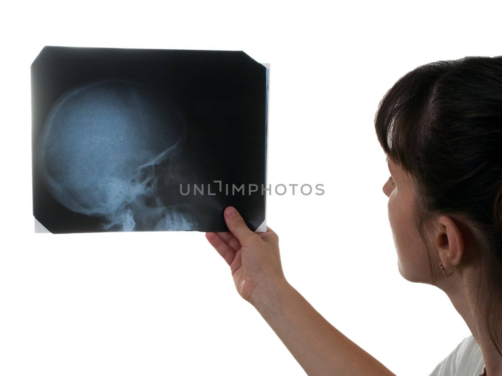 X-ray medicine film of human skull bone in hand