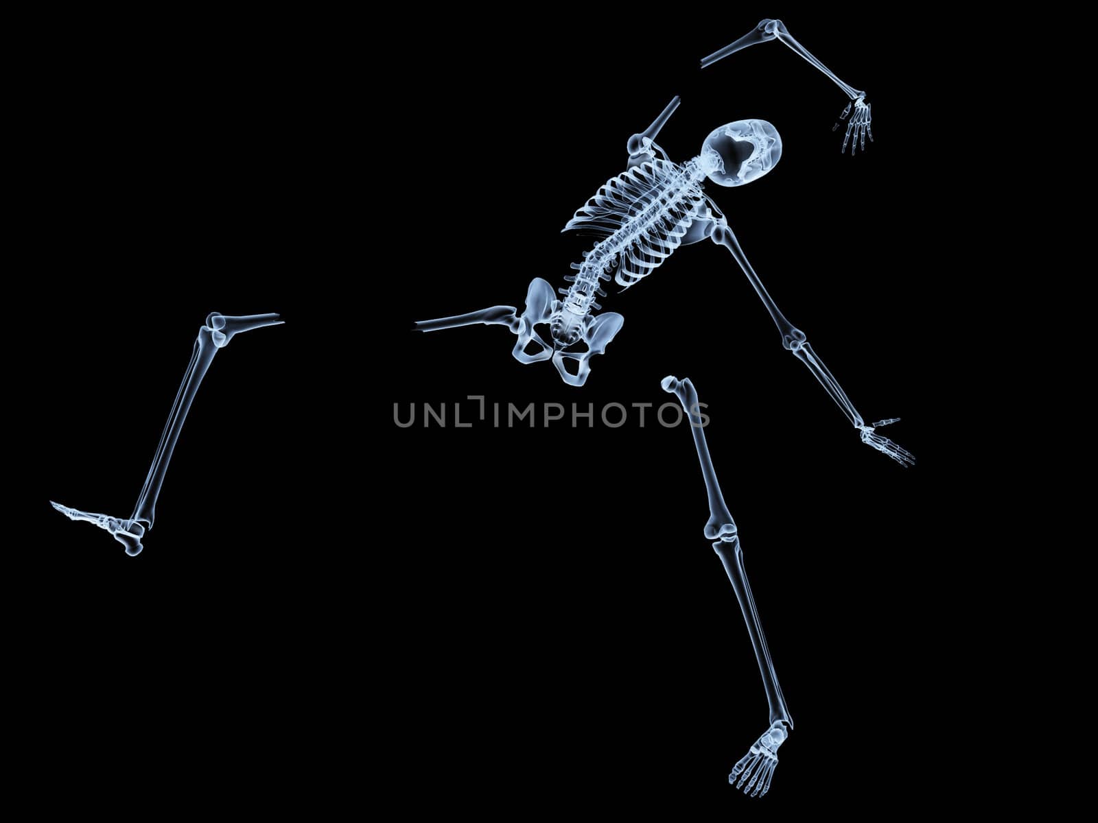 X rayed skeleton that is broken and shattered.