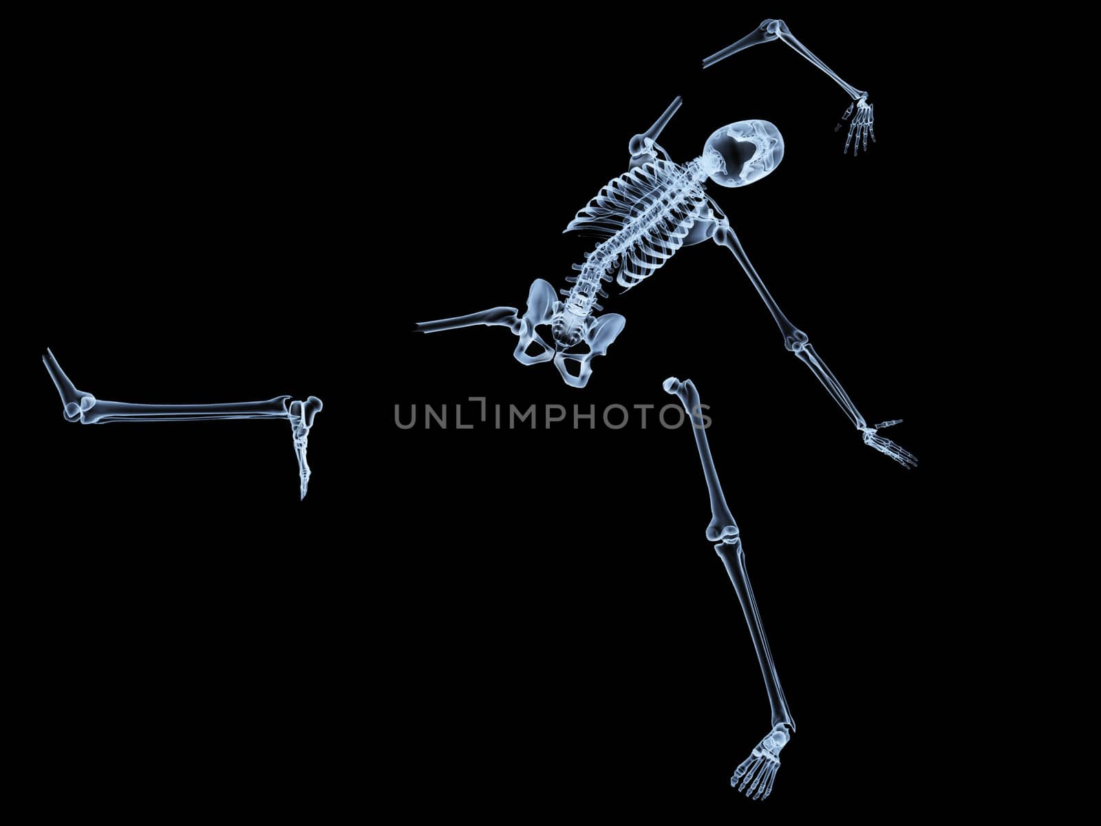 X rayed skeleton that is broken and shattered.