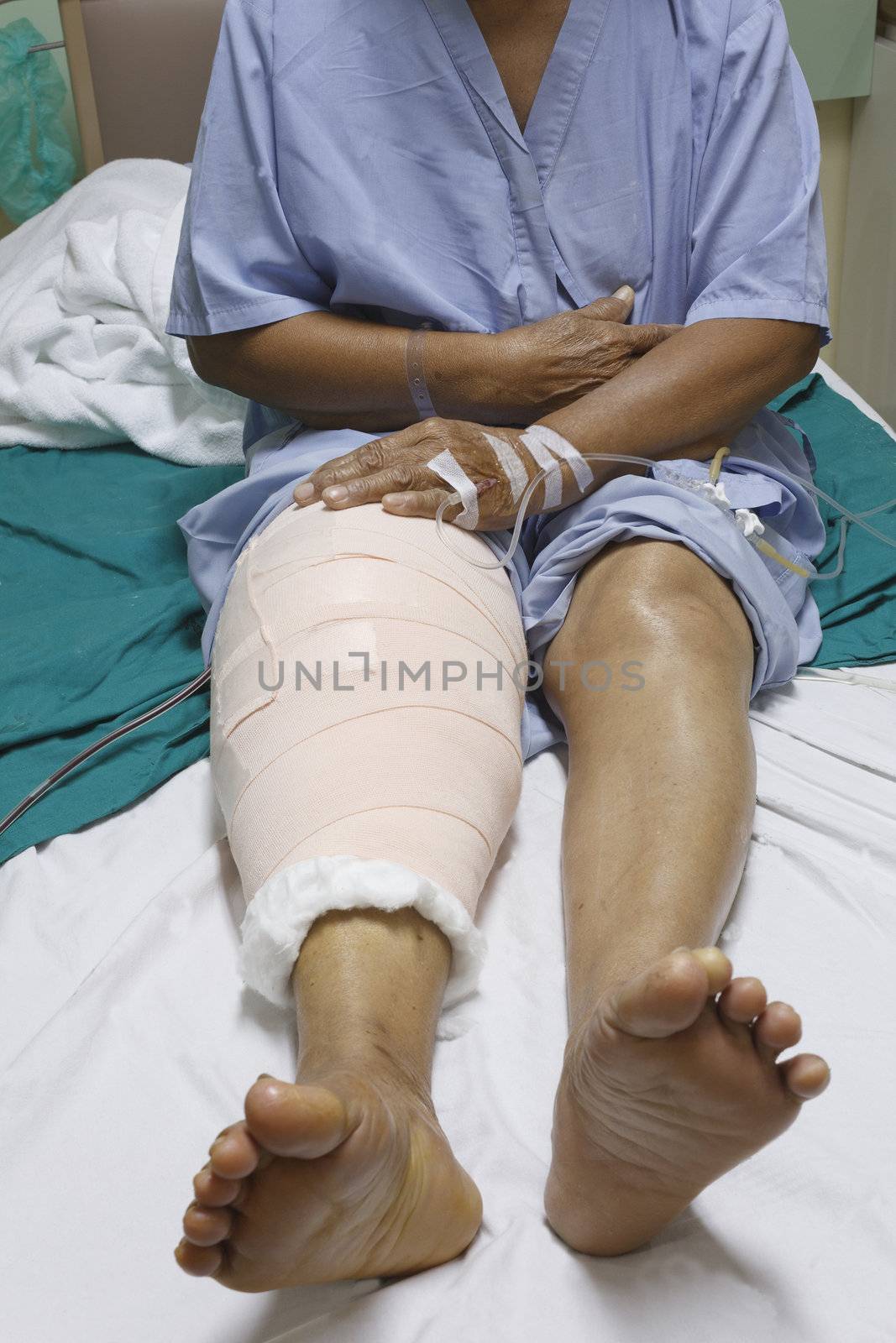 Knee replacement incision by olovedog