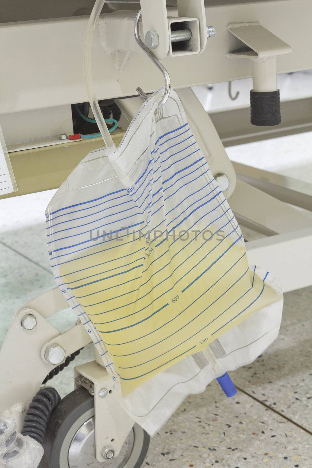 Urine bag or pee bag beside bed in hospital, urinary catheter (Foley Catheter)