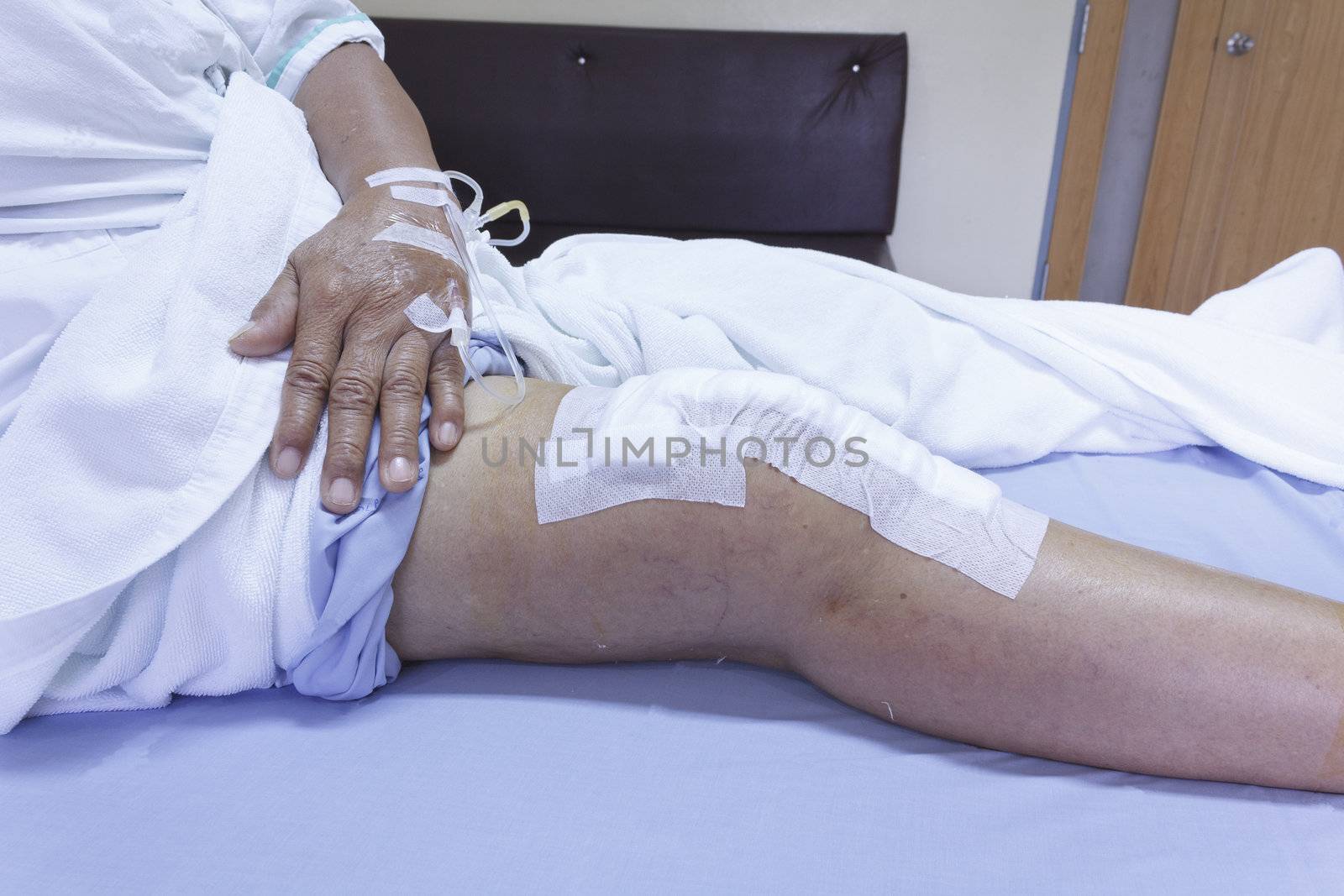 Knee replacement surgery after operation patient senior woman (60s) on the bed in hospital