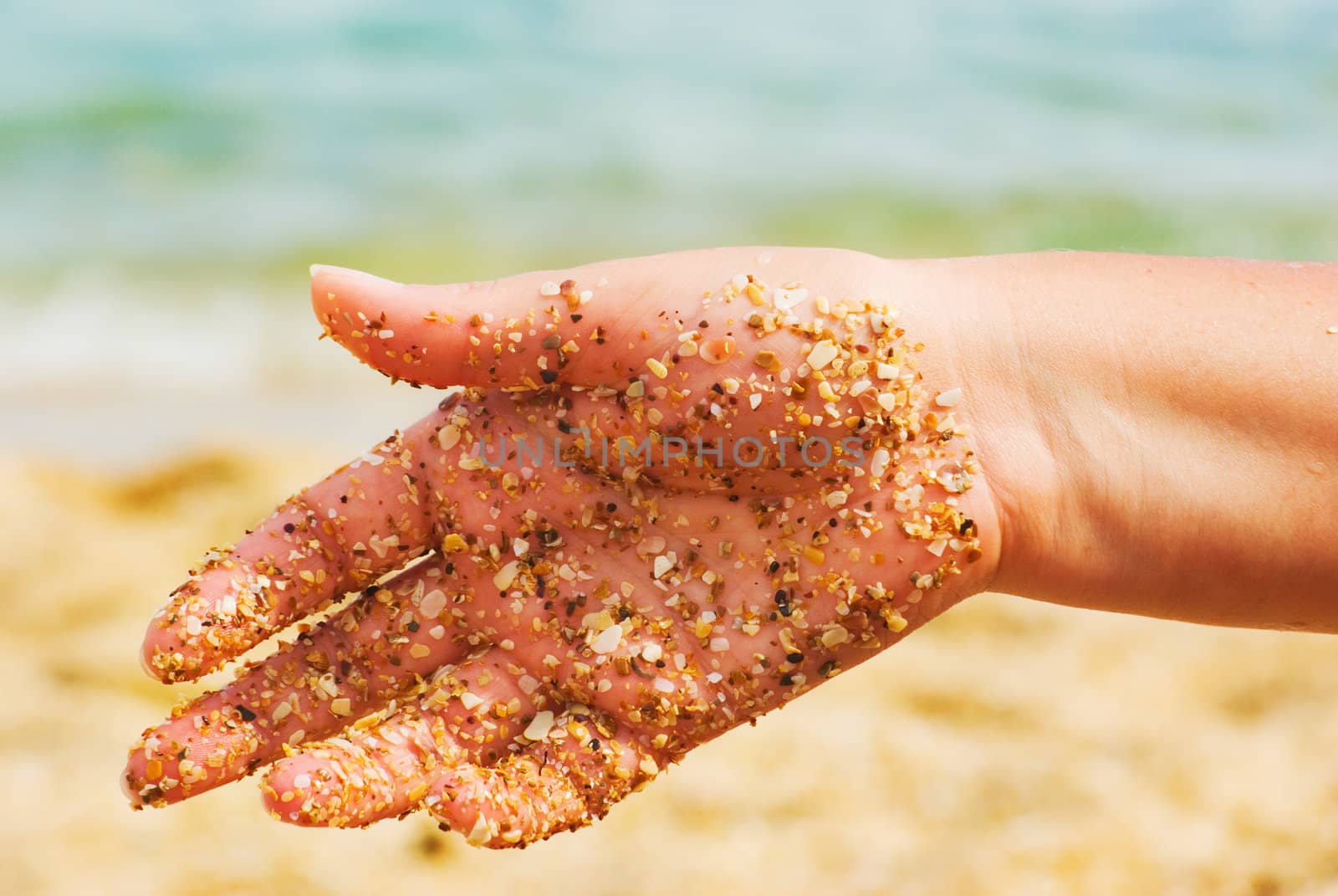 Small shells clinging to the arm