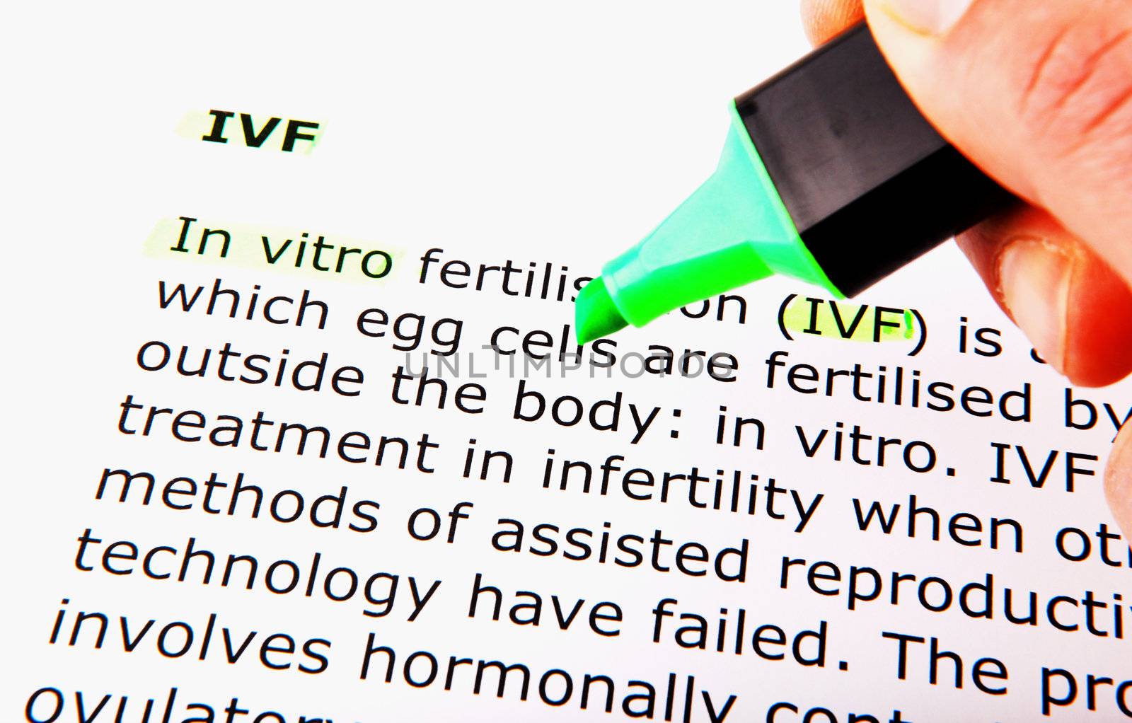 IVF