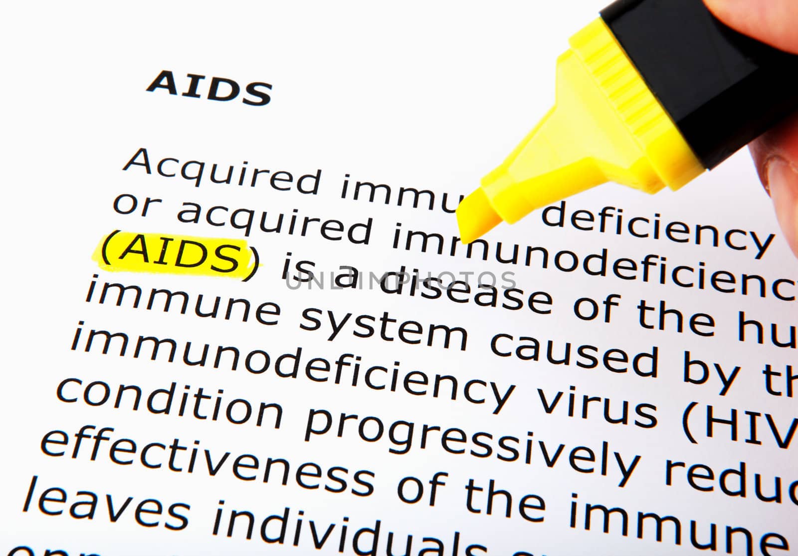AIDS