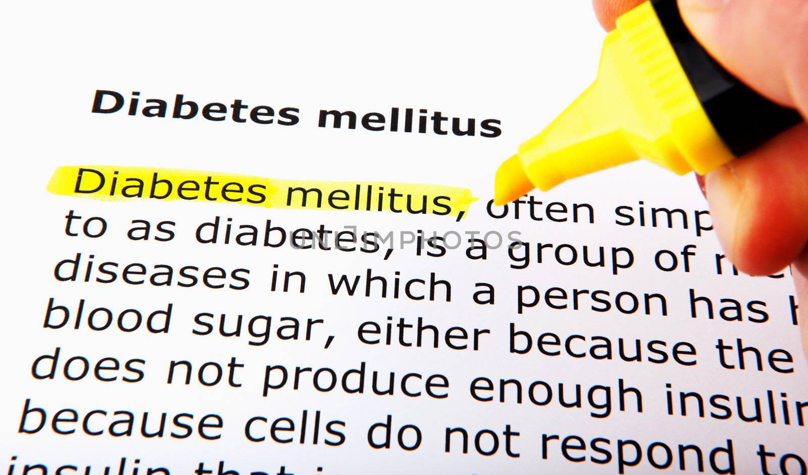 Diabetes mellitus