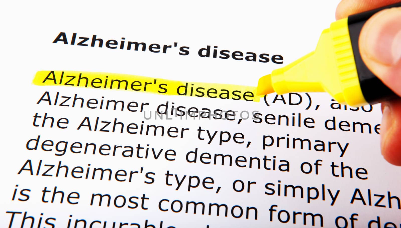 Alzheimer's disease