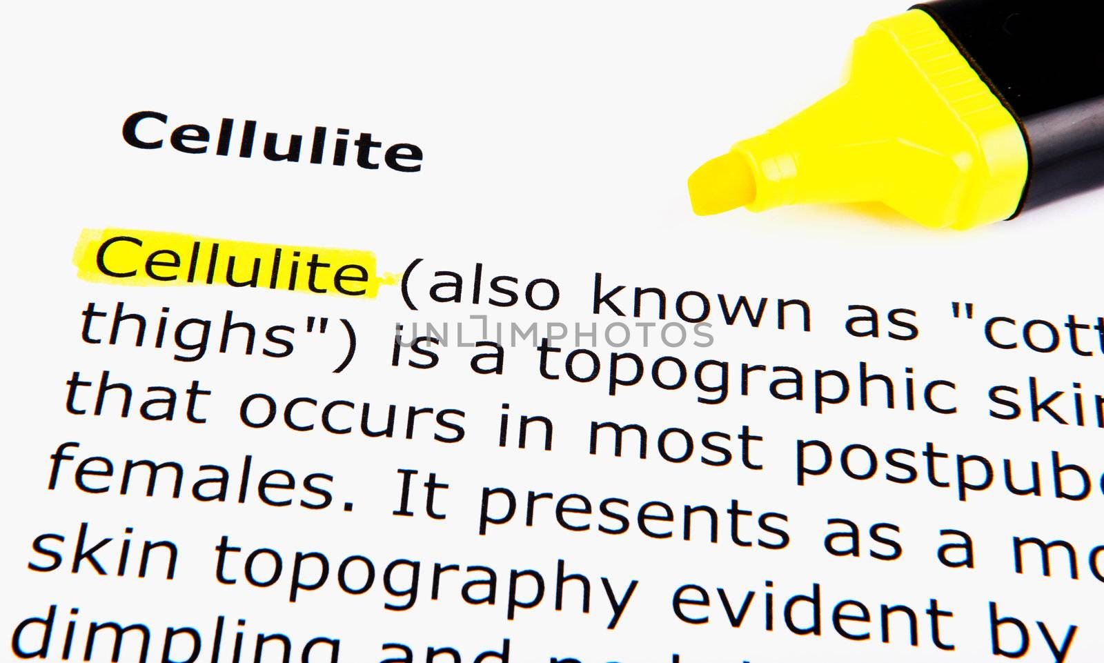 Cellulite