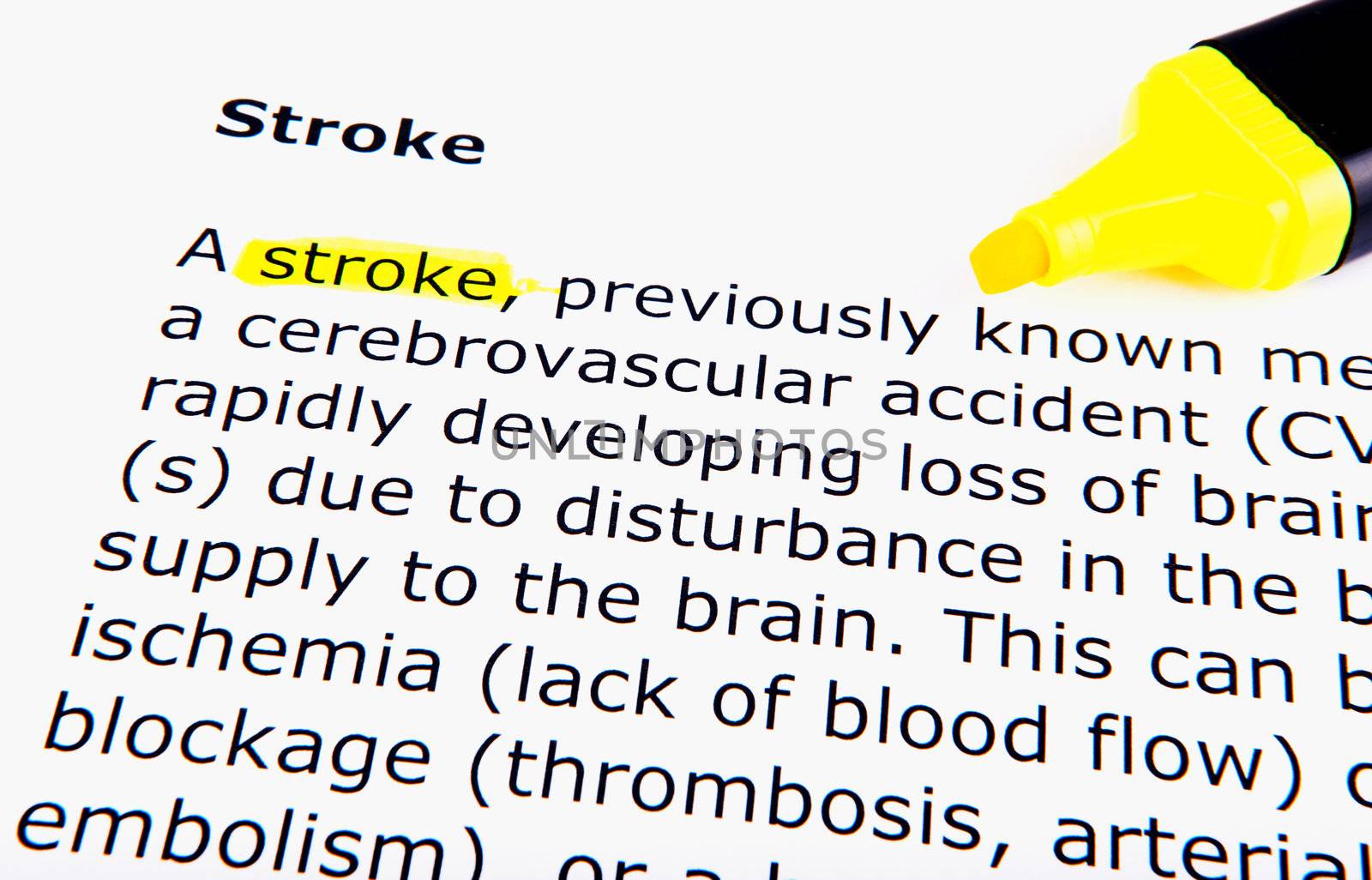 Stroke