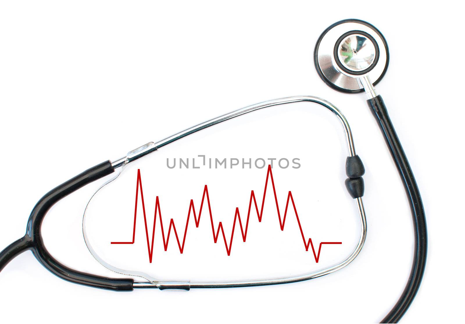 Close up of an electrocardiogram (ECG) graph inside a medical stethoscope