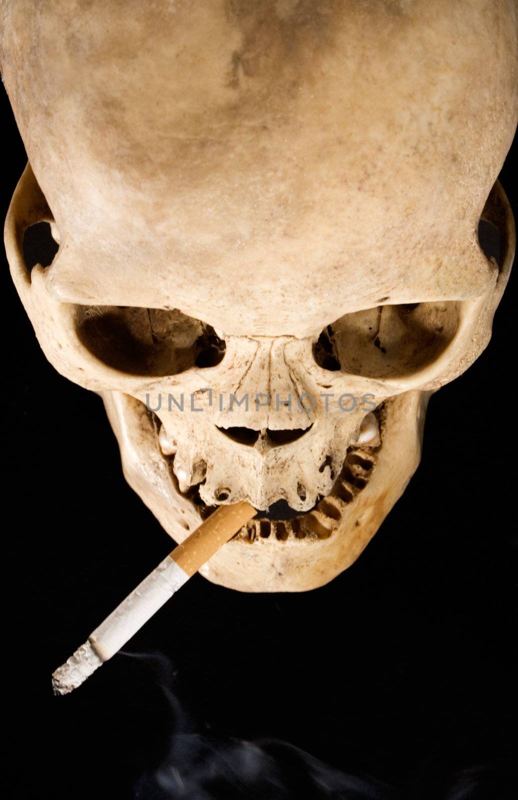 Human Skull and Cigarette by winterling