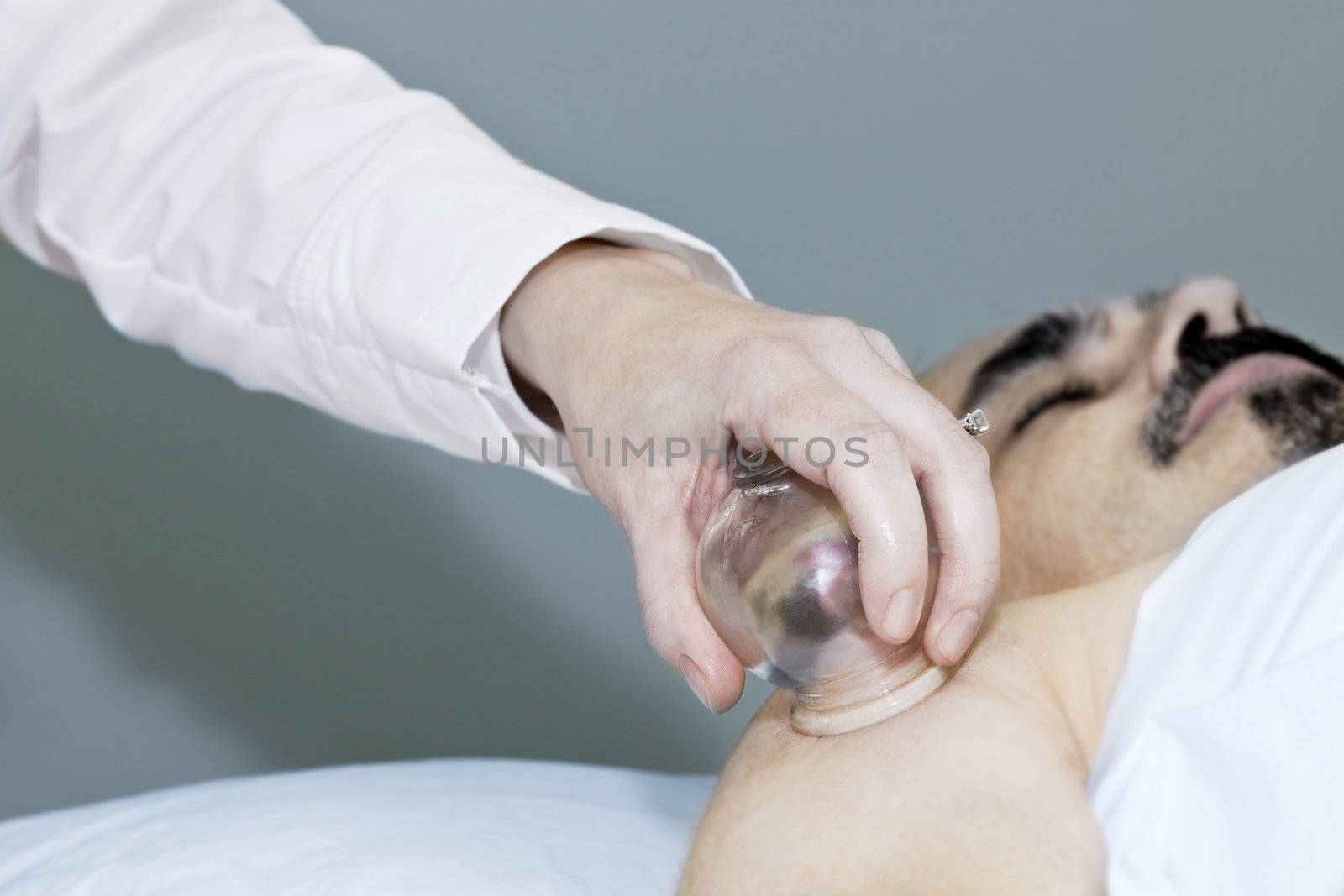 Applying cupping therapy in traditional chinese medicine on man's shoulder