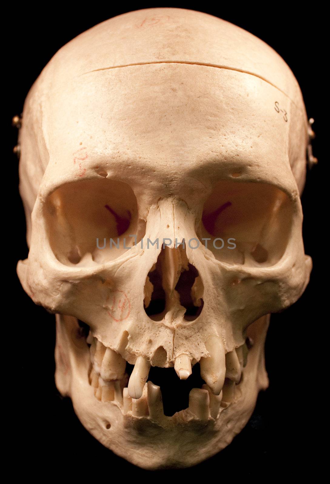 Human skull studio shot with a black background.