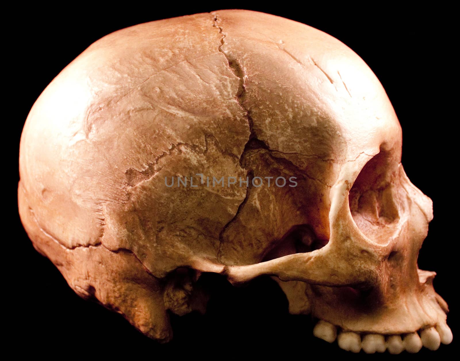 Human skull studio shot with a black background.