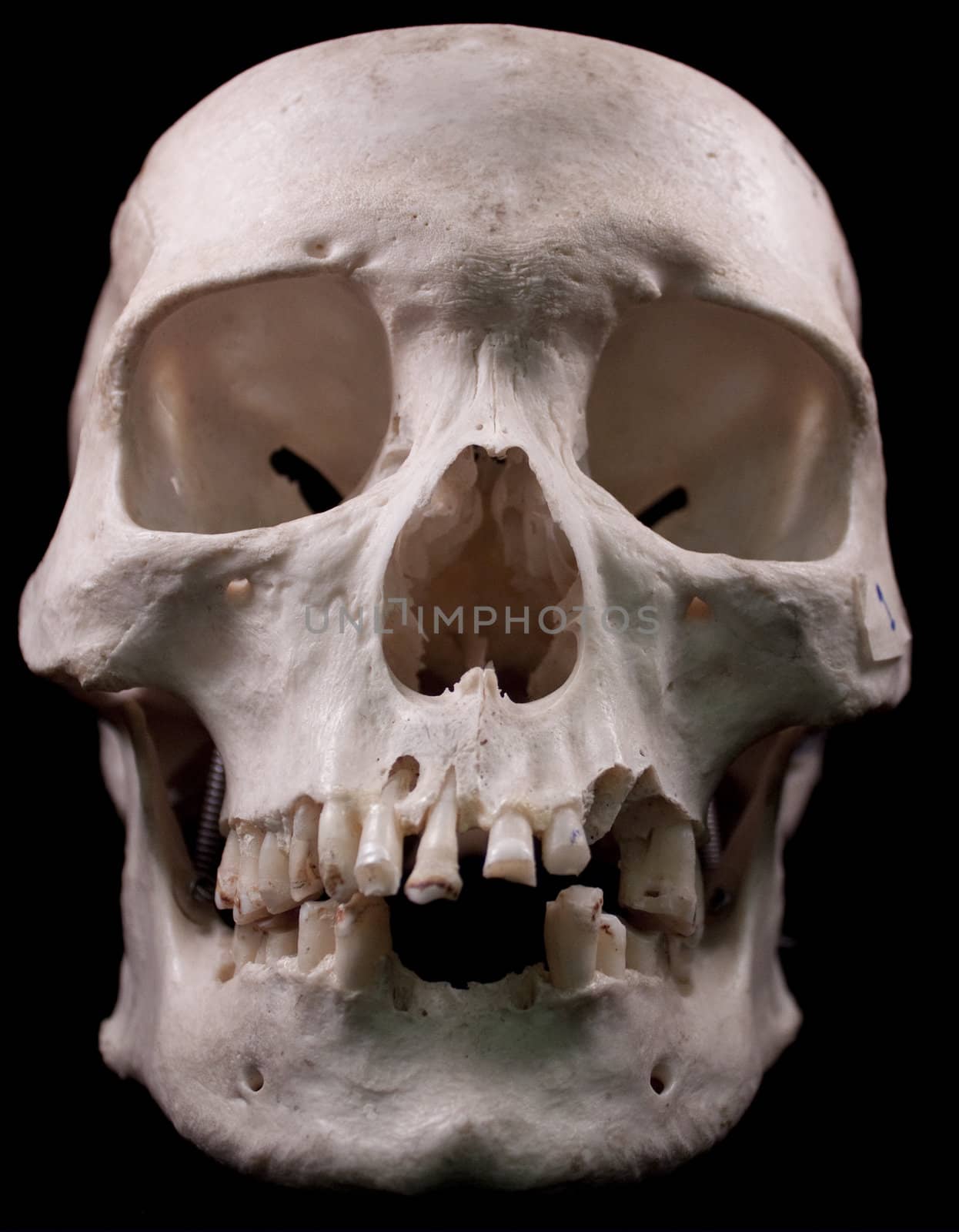 Human skull studio shot with a black background.