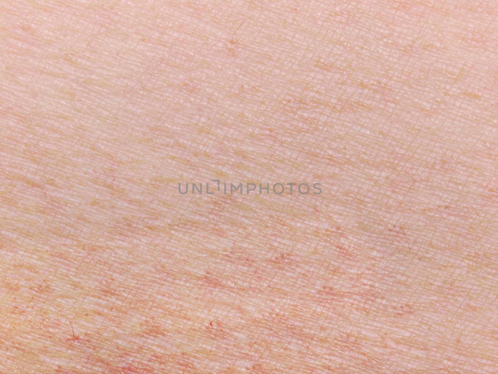 human skin by zkruger
