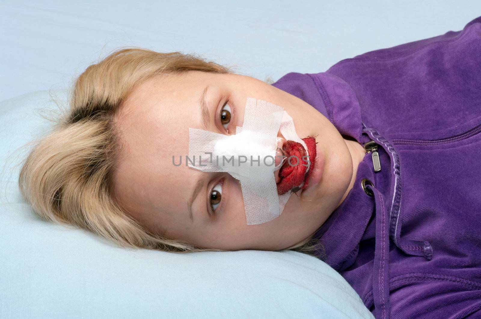 Girl in a blood-stained bandage after operation on a nose.