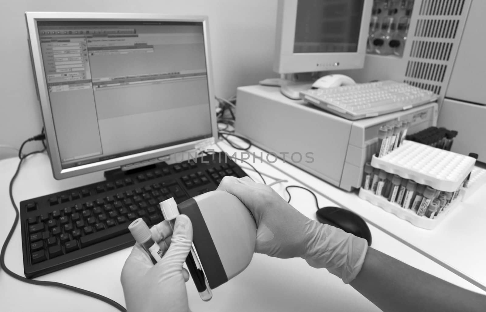 Two hands with gloves marking blood sample tubes for analysis