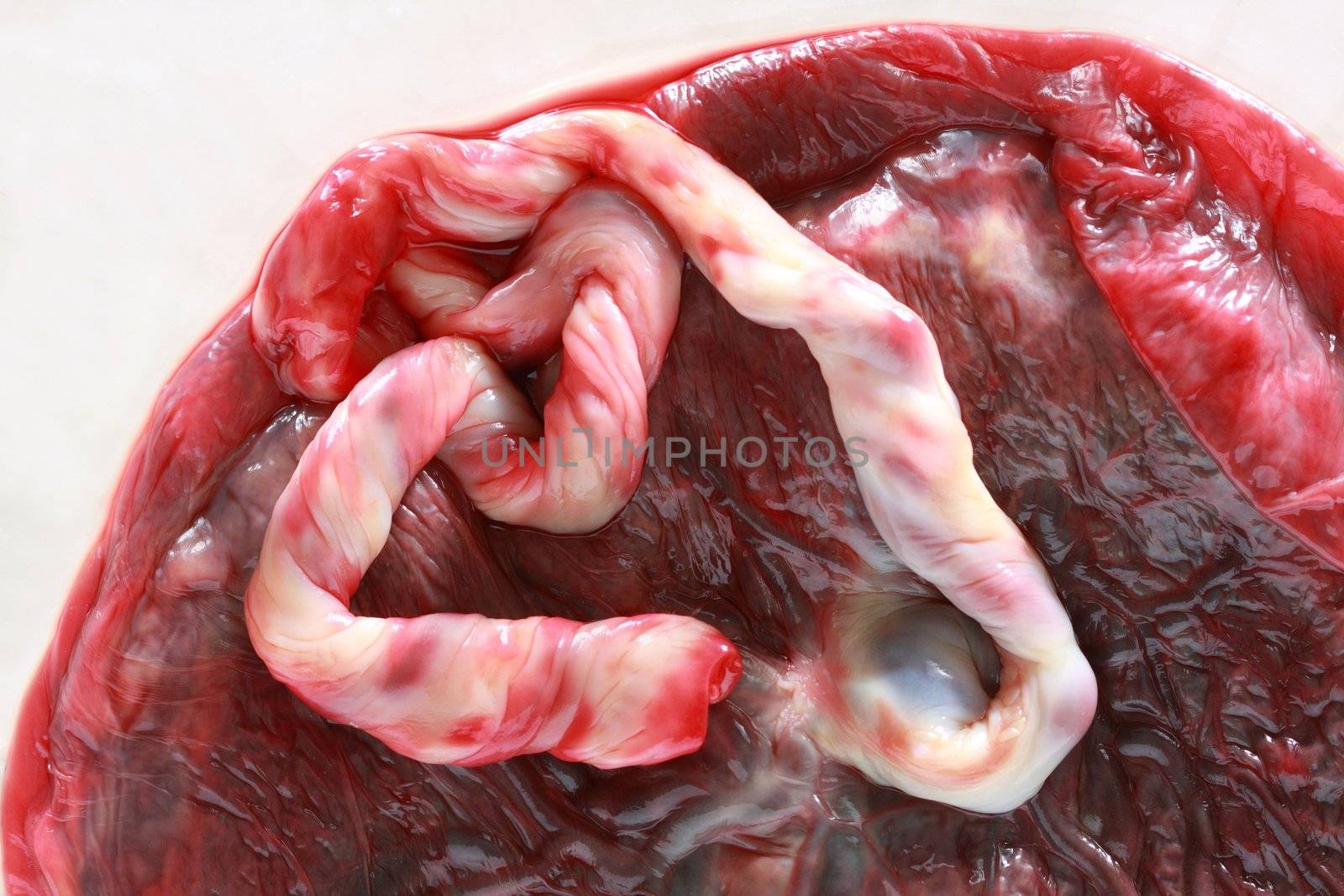 Human Placenta by photosoup