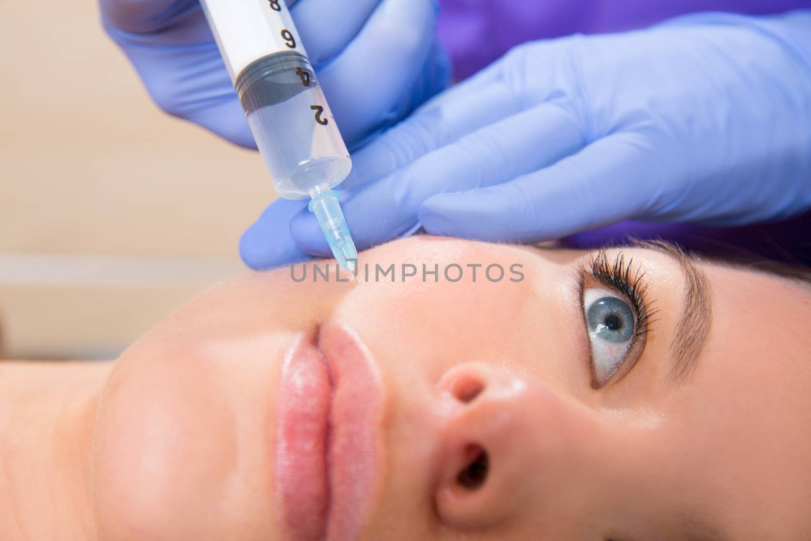 Anti aging facial mesotherapy syringe on woman face by lunamarina
