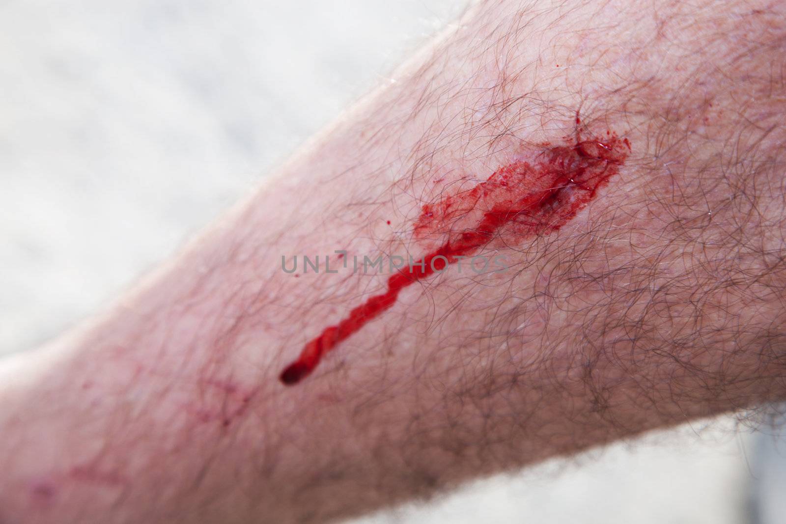 Blood on a male leg skin. Injury, accident