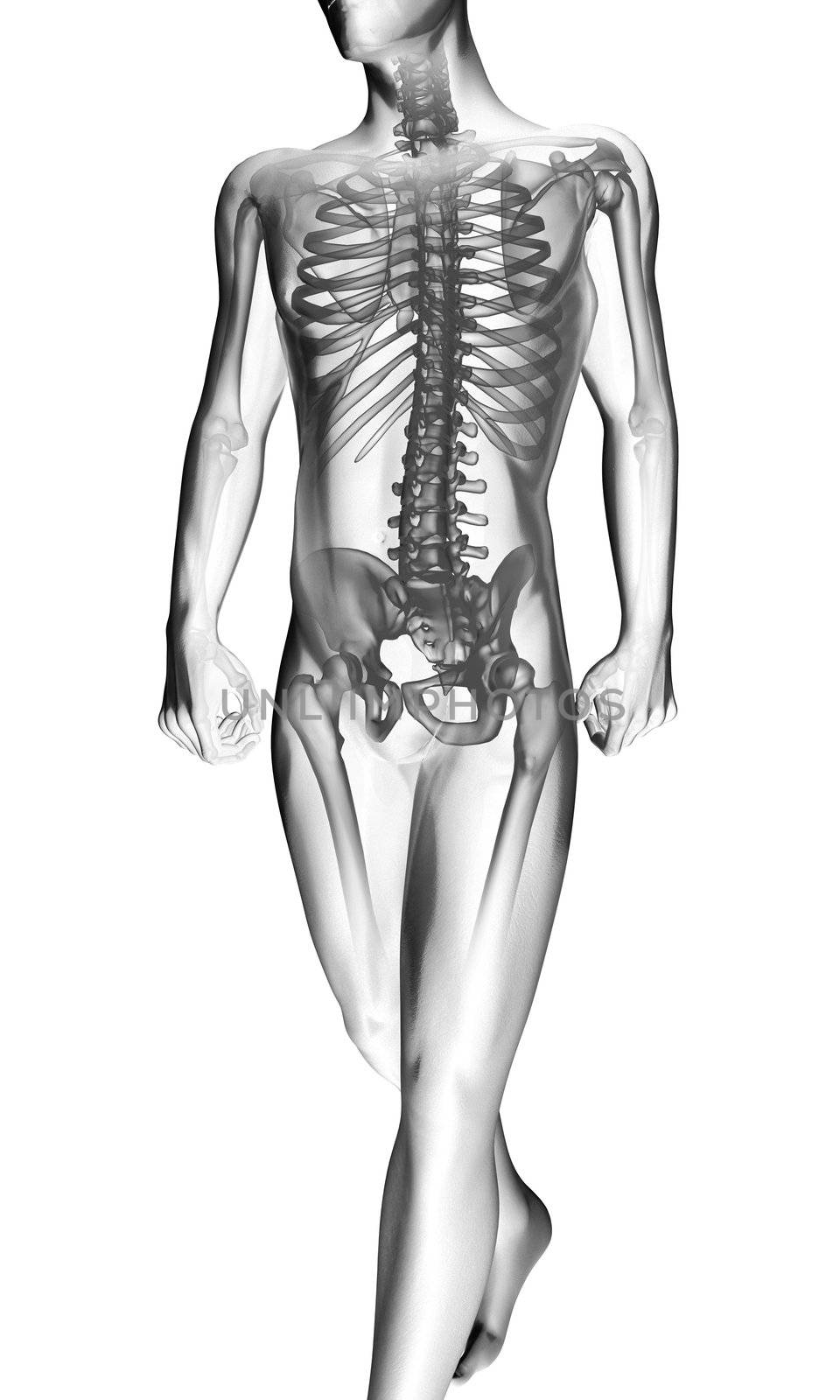 human radiography scan by videodoctor