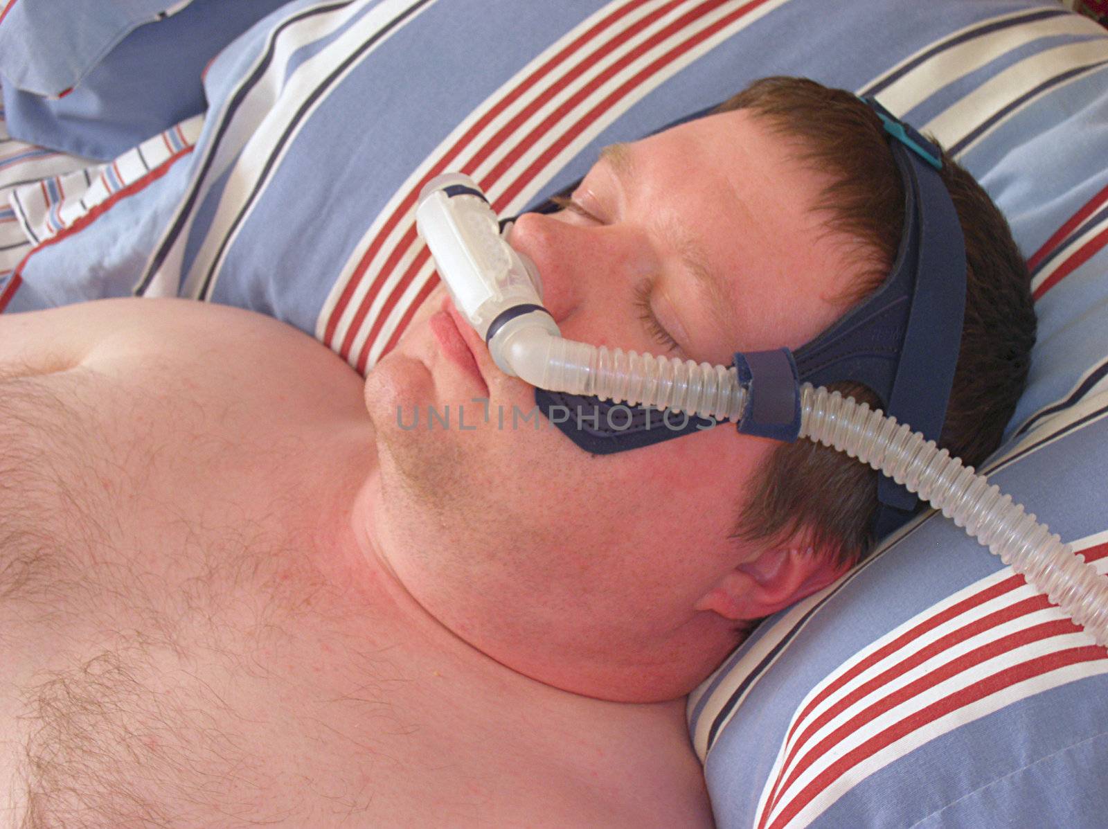 Man wearing CPAP nasal pillow facemask by paulglover