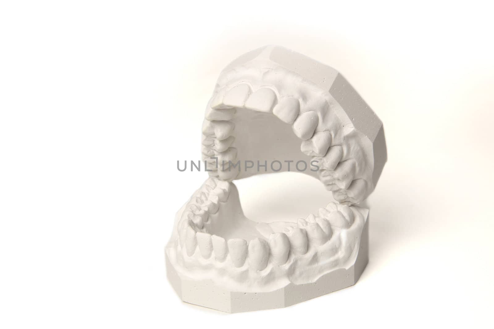 Plaster cast of set of teeth by kaarsten
