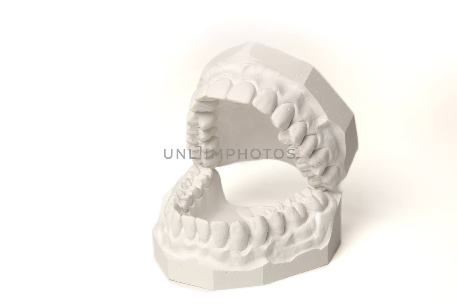 A plaster cast in blue tone of a set of teeth. All isolated on white background.