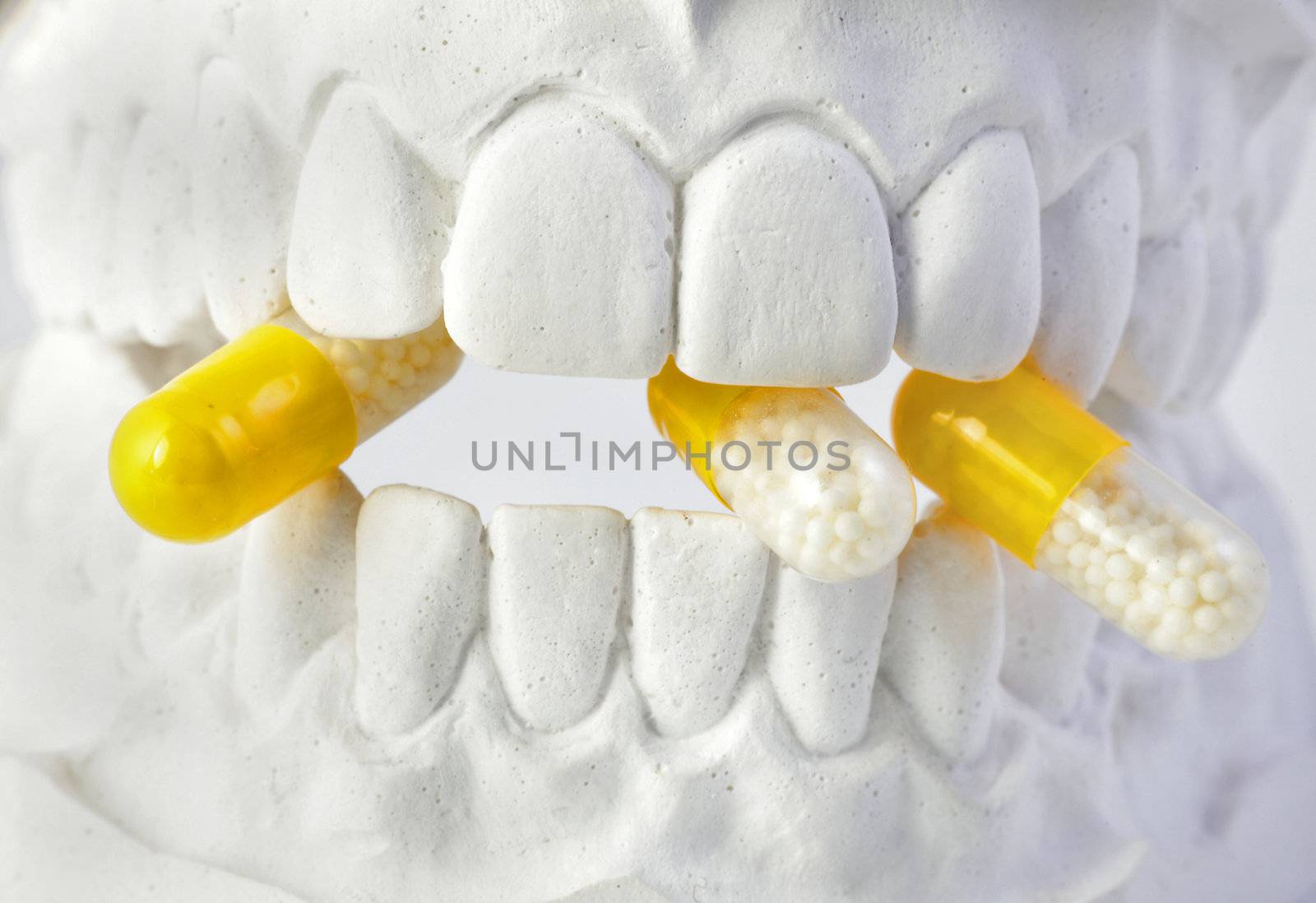 A plaster cast of teeth with with yellow pills. All on white background.