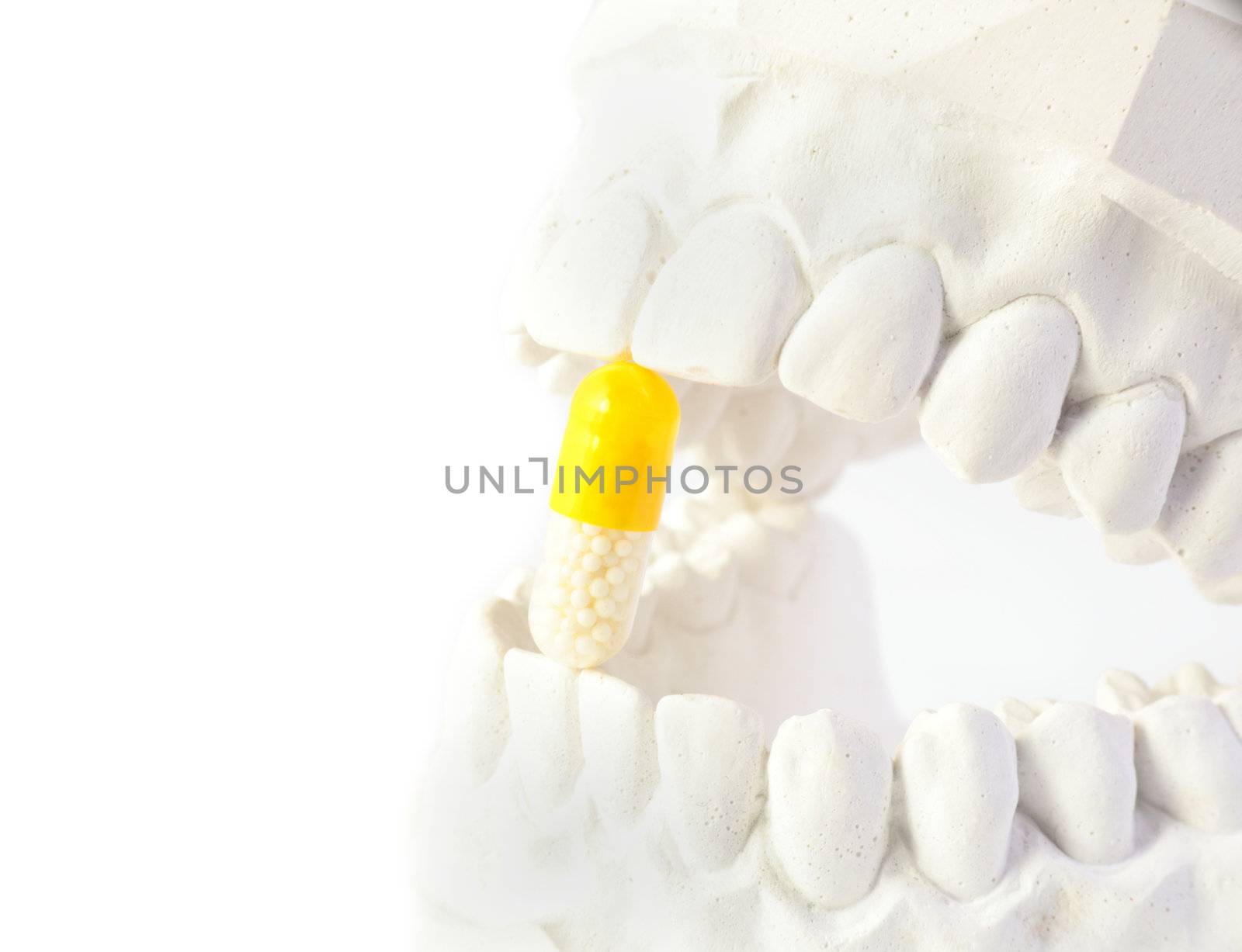 A plaster cast of teeth with with a yellow pill. All on white background.