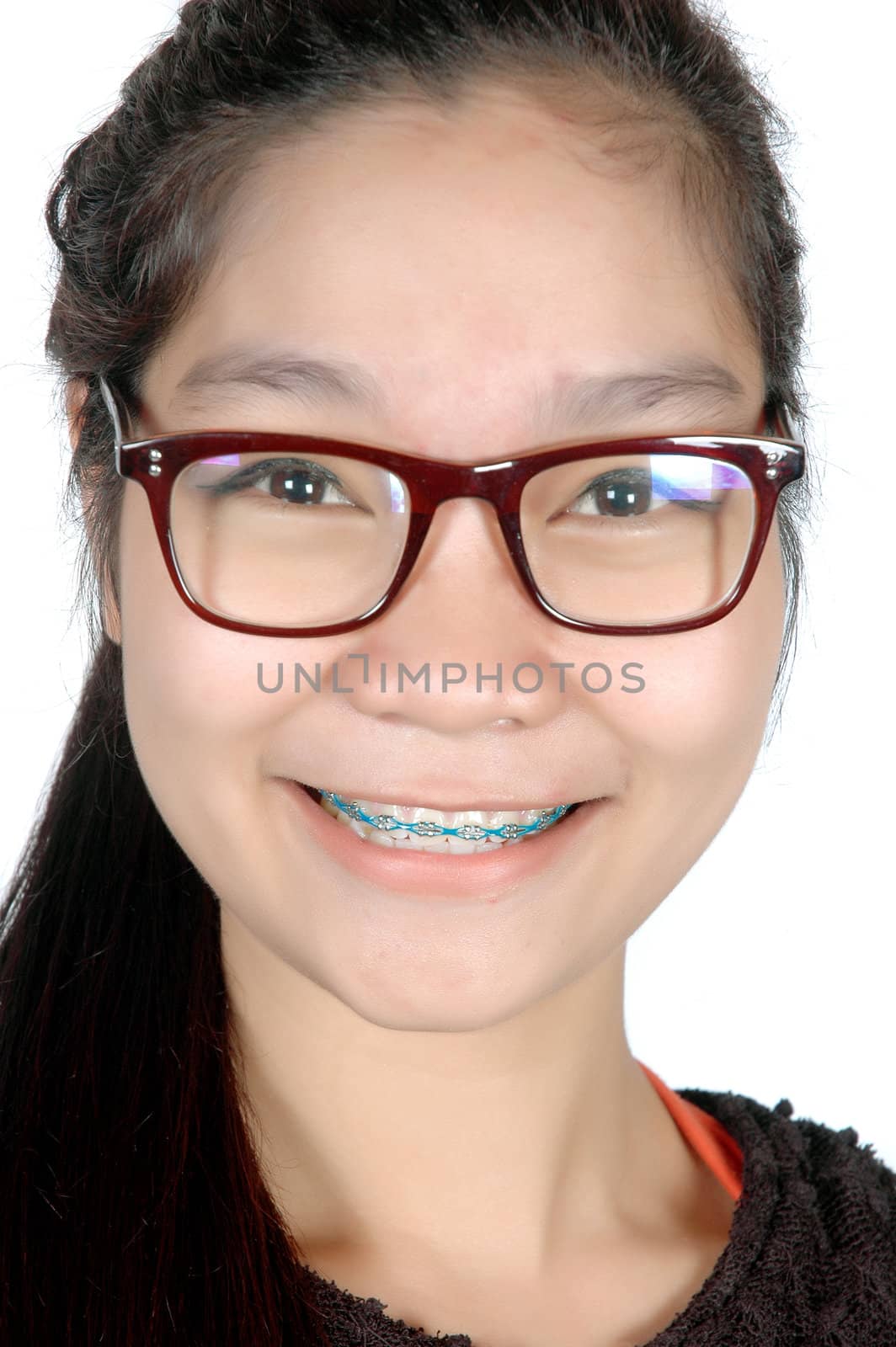 portrait of asian young girl with glasses and braces isolated on white background