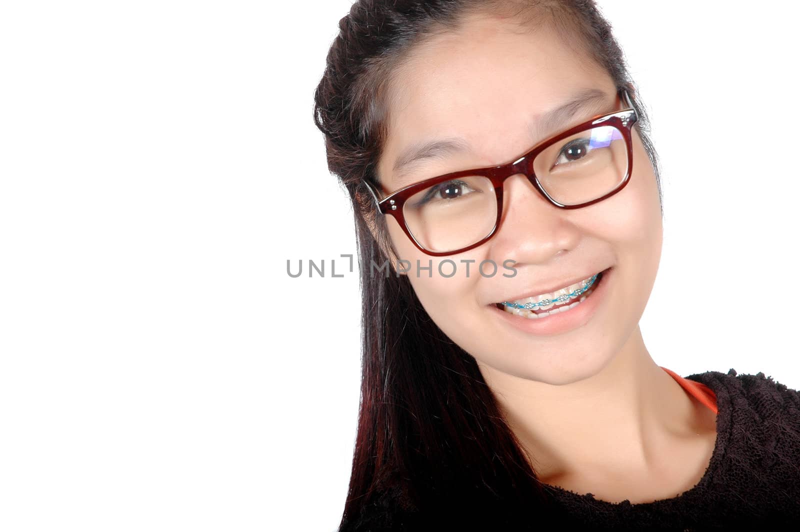portrait of asian young girl with glasses and braces  by antonihalim
