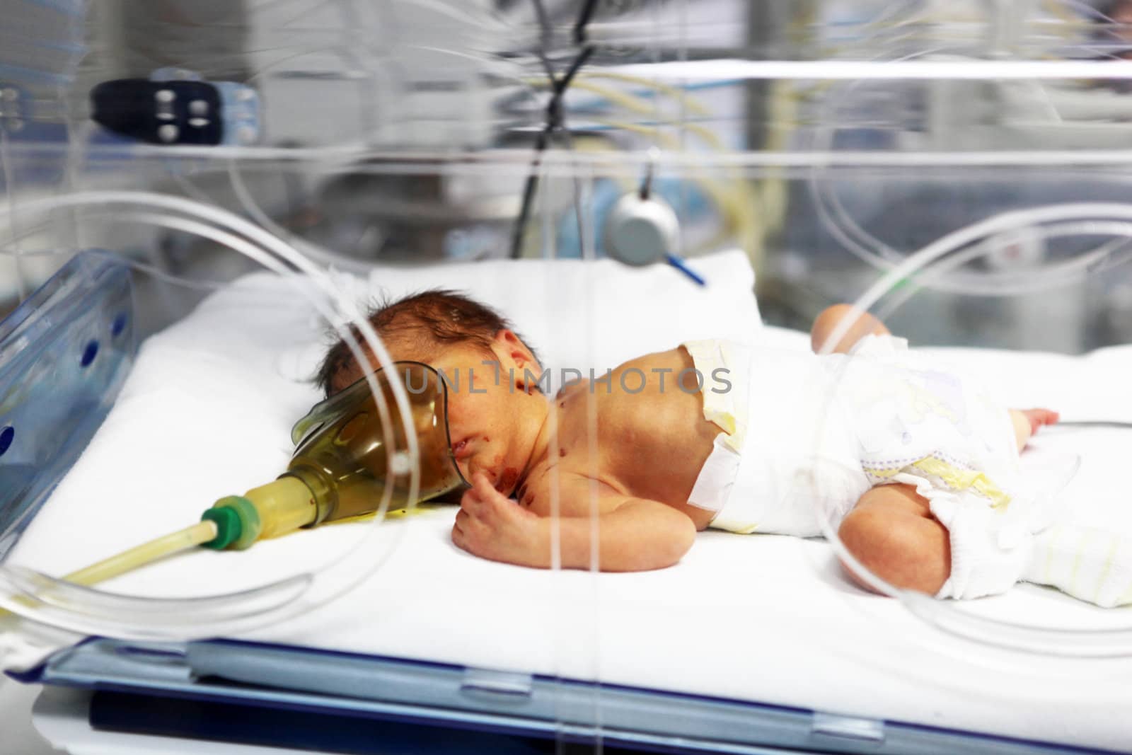 Newborn baby inside incubator